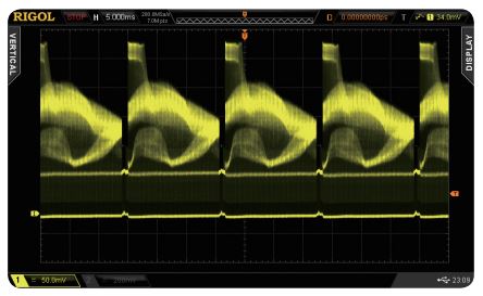 UltraVision multi-level intensity grading display